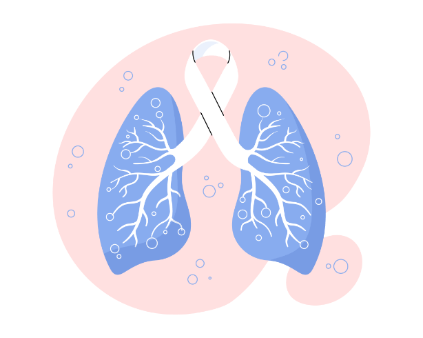 Lung Cancer | NBST